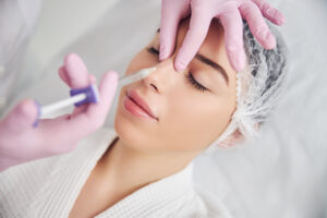 mujer tratamiento rinomodelacion definitiva permanente hilos clinica estetica taccone santiago chile
