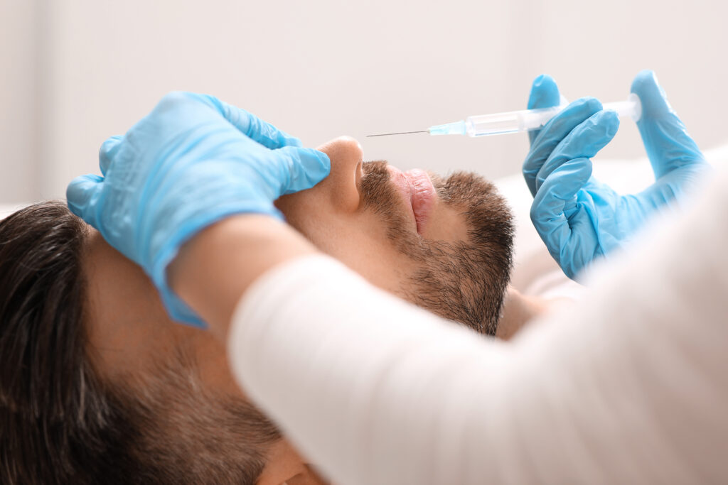 hombre recibiendo tratamiento rinomodelacion definitiva permanente clinica estetica taccone santiago chile