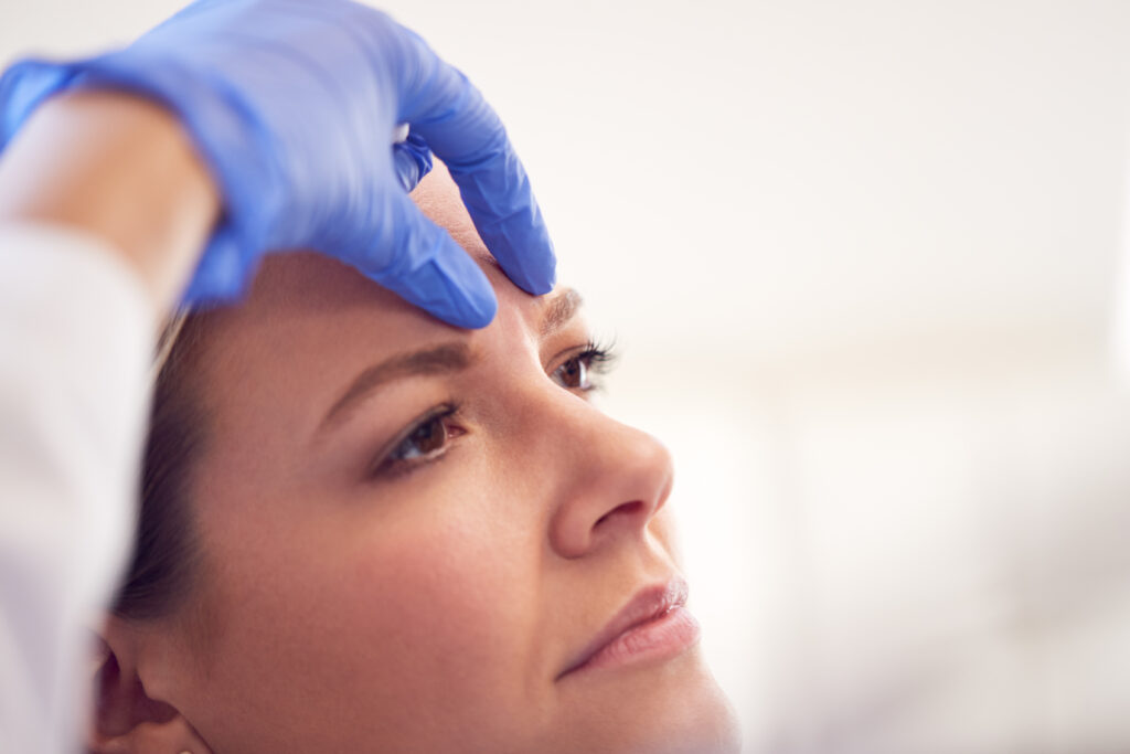 mujer recibiendo toxina botulinica botox en entrecejo tratamiento belleza clinica estetica taccone santiago chile