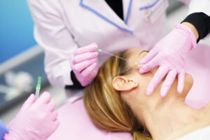 hilos pdo doctor inyectando a paciente tratamiento clinica estetica taccone santiago chile