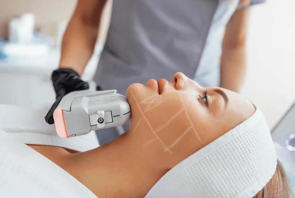 Tratamiento HIFU Facial: Rejuvenece Tu Rostro Sin Cirugía